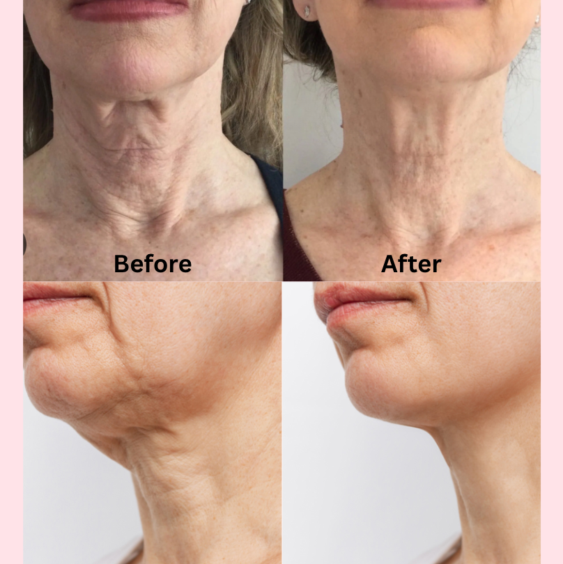 PDRN Gua Sha Neck Firmer