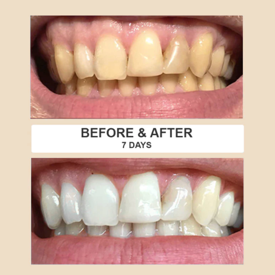 Miswak Teeth Whitener